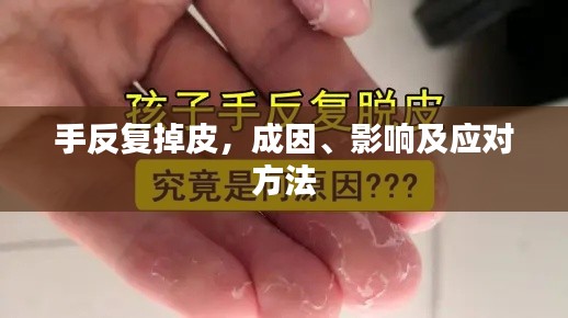 手反复掉皮,成因、影响及应对方法